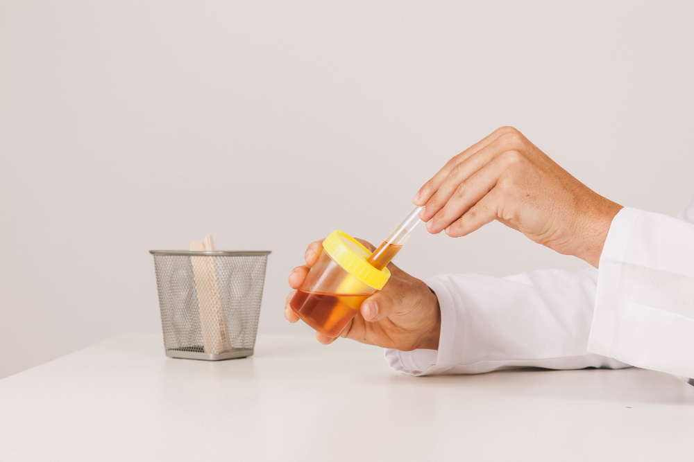 urine-test-doctor-s-hands